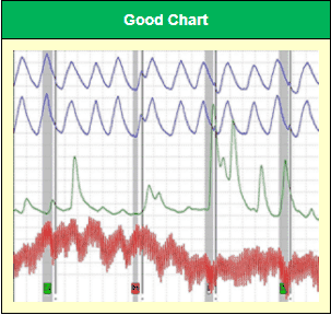 Good Chart