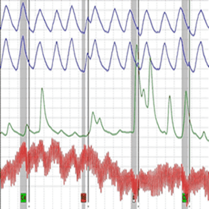 Polygraph Test