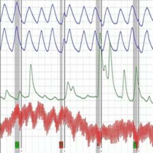 False vs Inconclusive Polygraph Results Explained Clearly